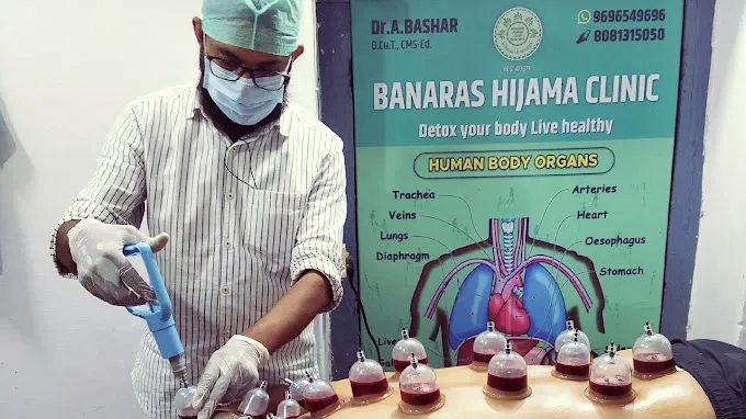 Banaras Hijama Clinic